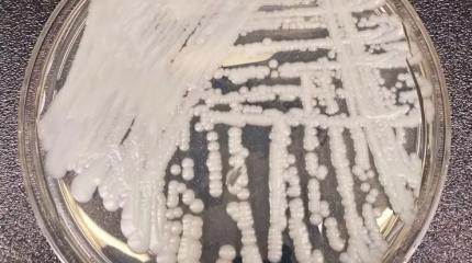 Candida auris: учёные из Сингапура с тревогой обнаружили новый штамм больничных грибков